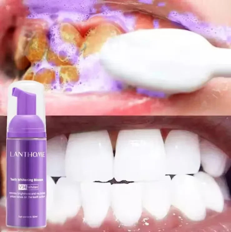 LumiSmile - V34 Advanced Whitening Toothpaste