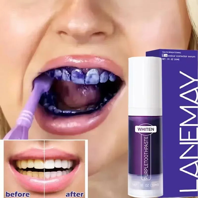 LumiSmile - V34 Advanced Whitening Toothpaste